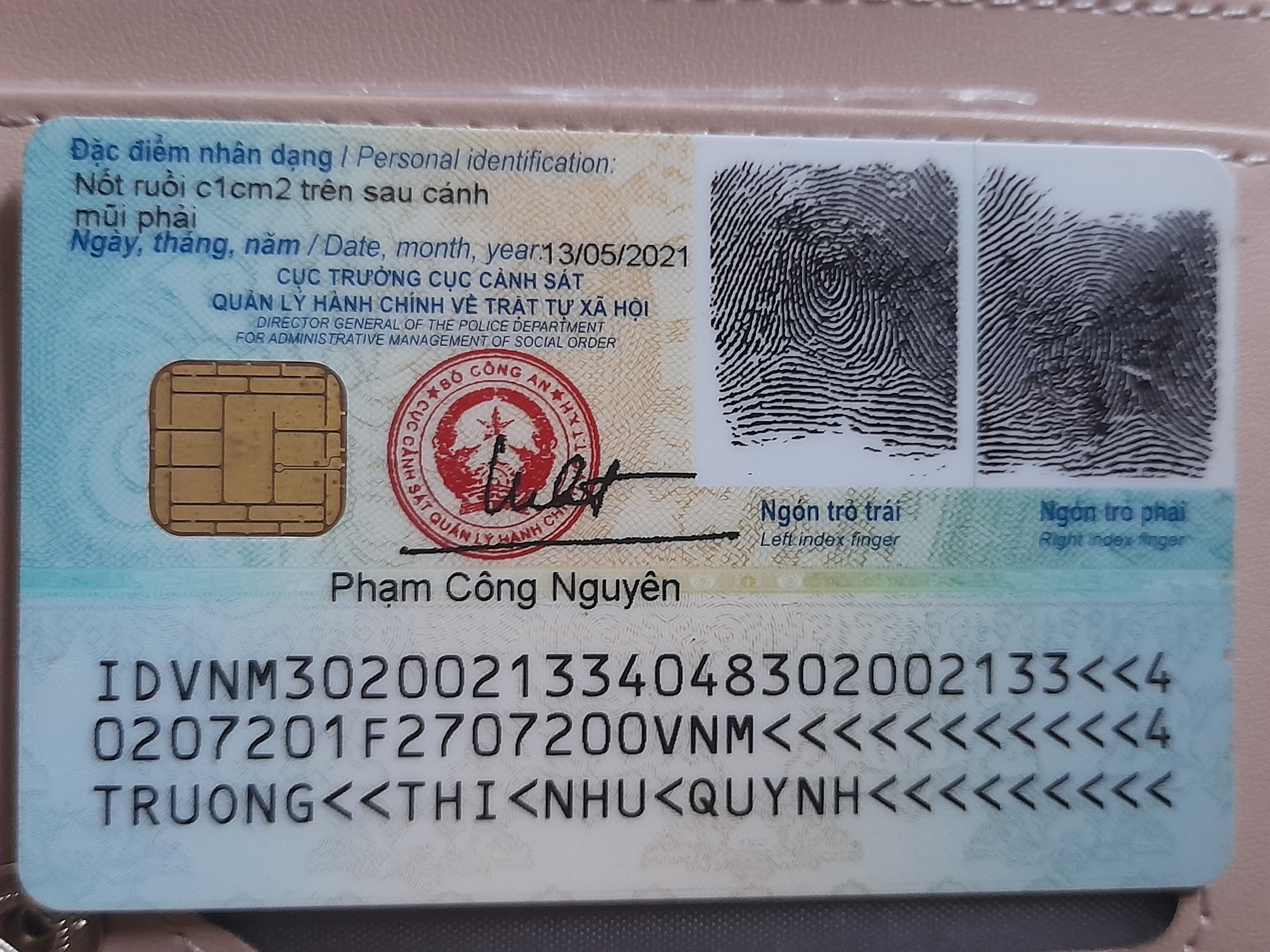 lỗi ảnh mặt sau